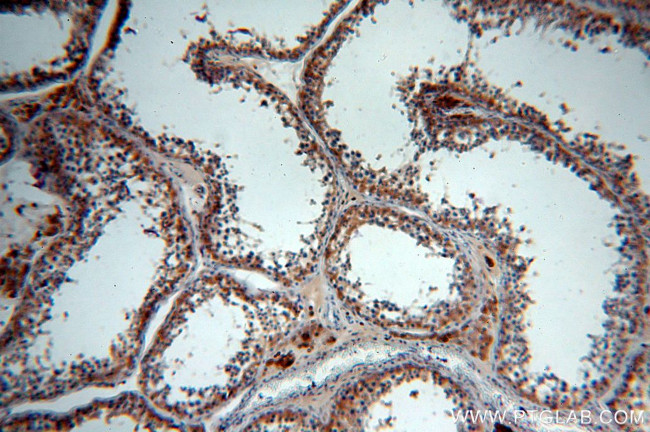 PRPS1 Antibody in Immunohistochemistry (Paraffin) (IHC (P))