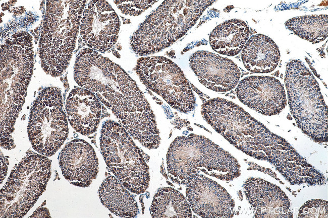 PRPS1 Antibody in Immunohistochemistry (Paraffin) (IHC (P))