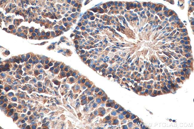 PRPS1 Antibody in Immunohistochemistry (Paraffin) (IHC (P))