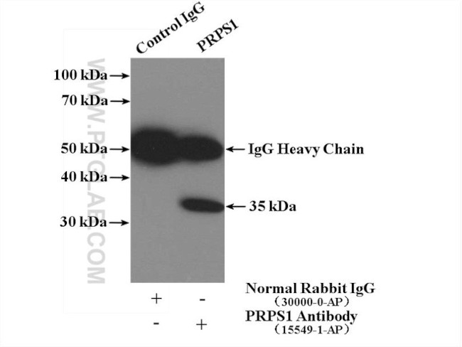 PRPS1 Antibody in Immunoprecipitation (IP)