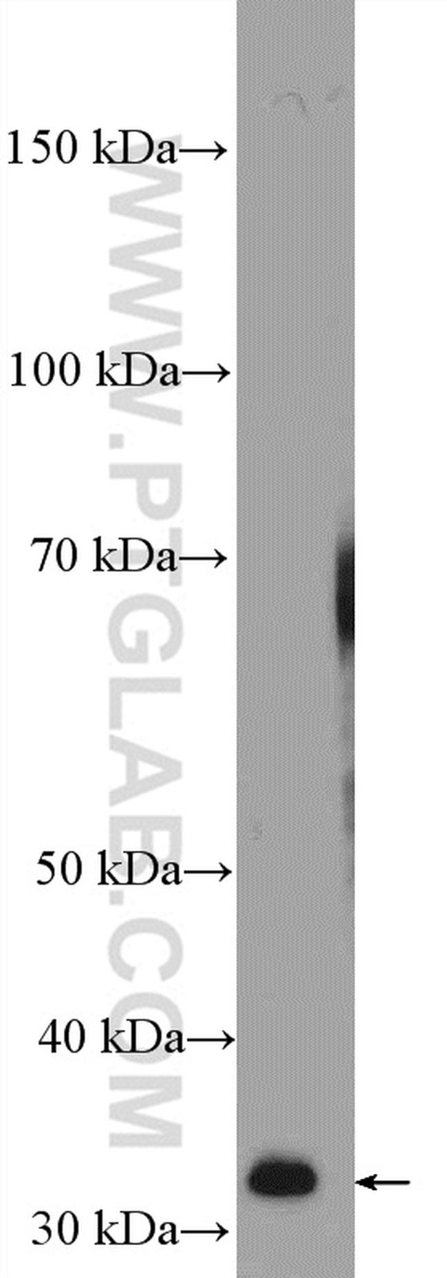 PRPS1 Antibody in Western Blot (WB)