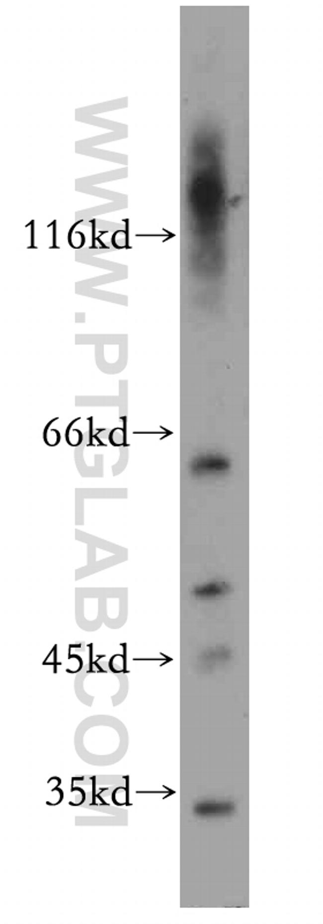PRPS1 Antibody in Western Blot (WB)