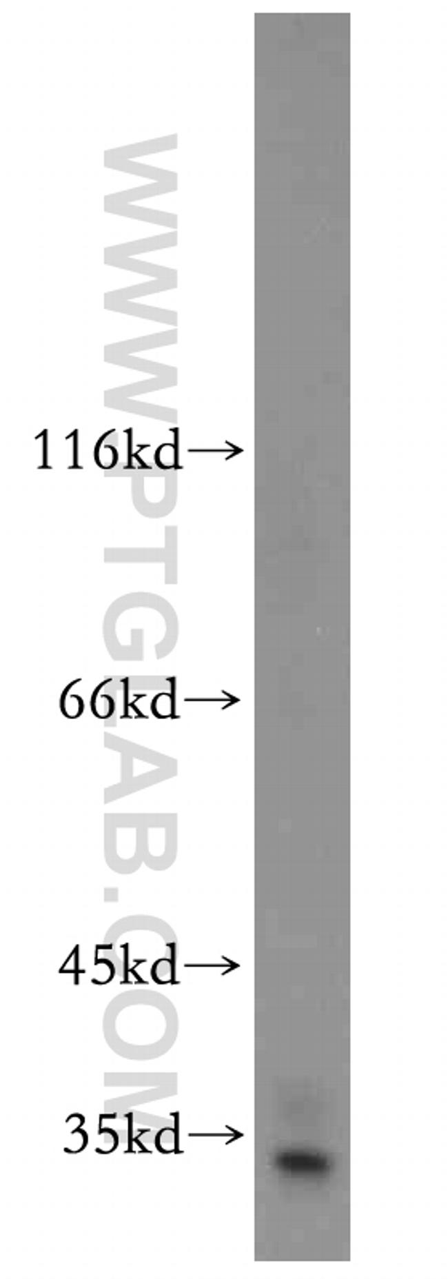 PRPS1 Antibody in Western Blot (WB)