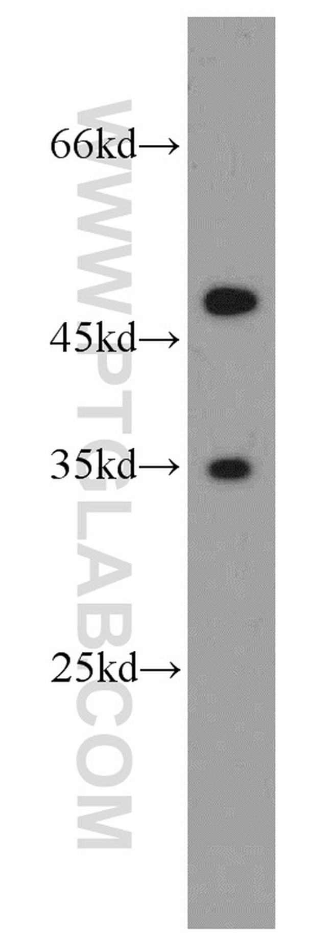 PRPS1 Antibody in Western Blot (WB)