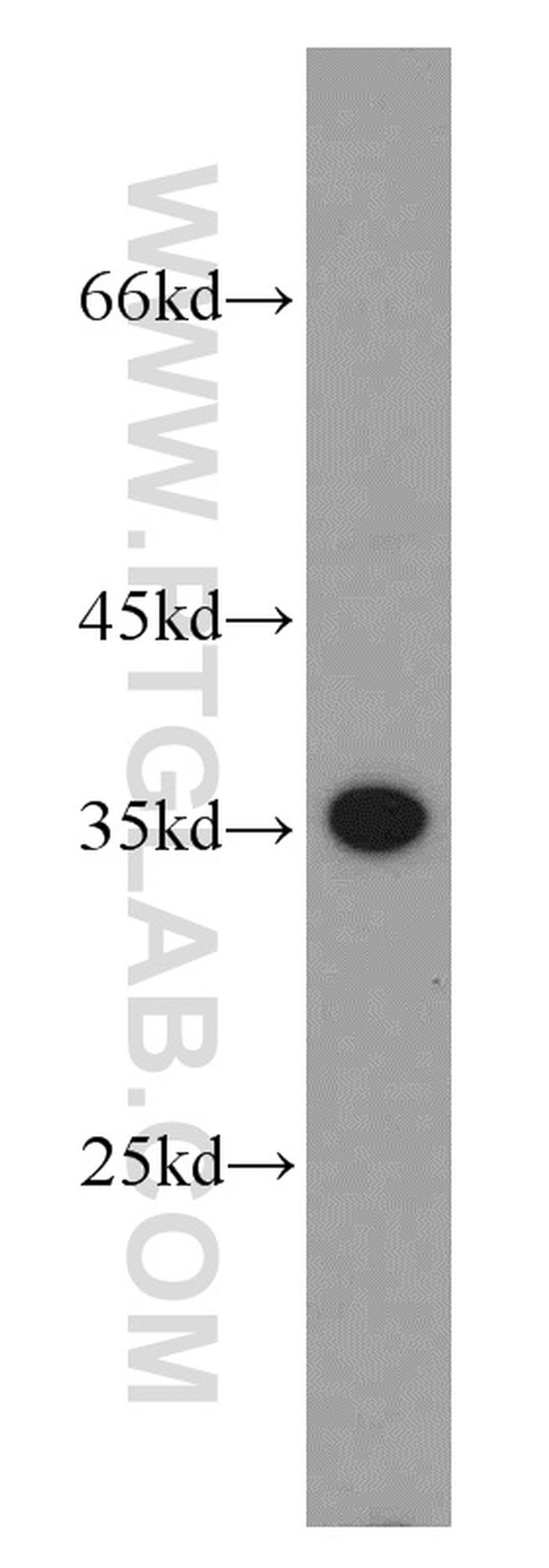 PRPS1 Antibody in Western Blot (WB)