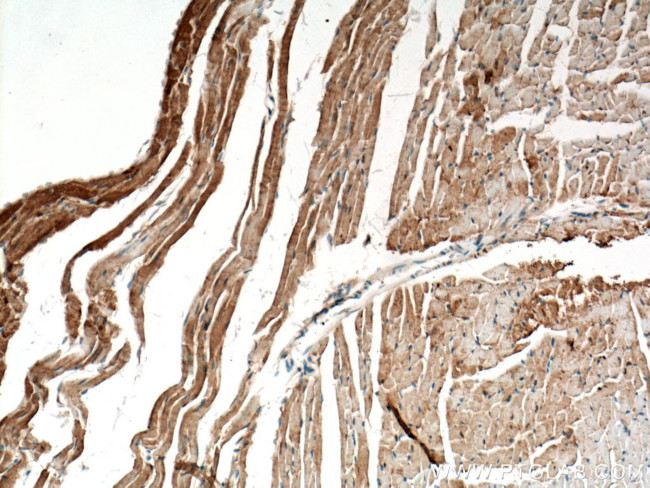 PGAM2 Antibody in Immunohistochemistry (Paraffin) (IHC (P))