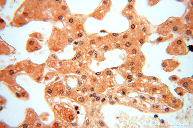 PGAM2 Antibody in Immunohistochemistry (Paraffin) (IHC (P))