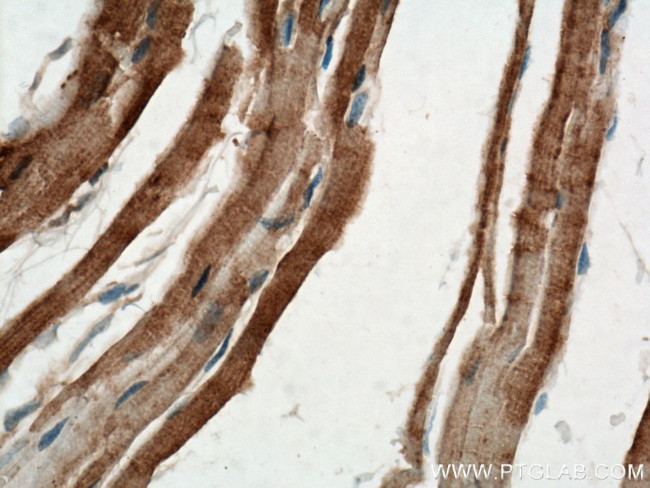 PGAM2 Antibody in Immunohistochemistry (Paraffin) (IHC (P))