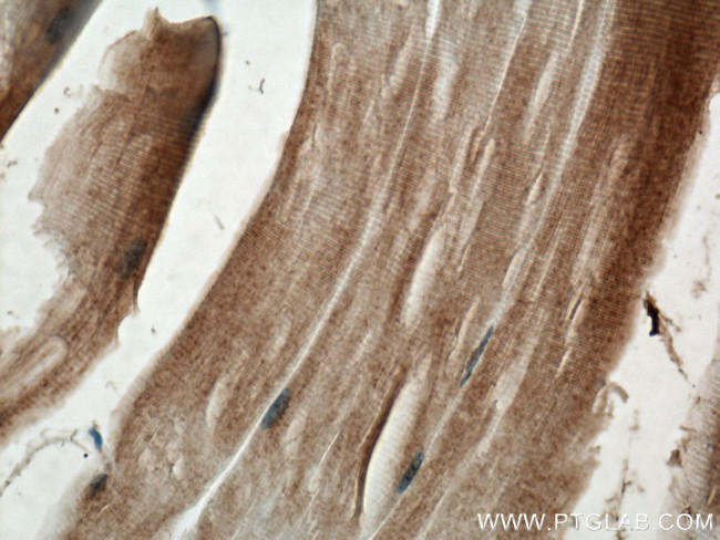 PGAM2 Antibody in Immunohistochemistry (Paraffin) (IHC (P))