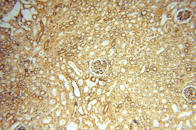 PGAM2 Antibody in Immunohistochemistry (Paraffin) (IHC (P))