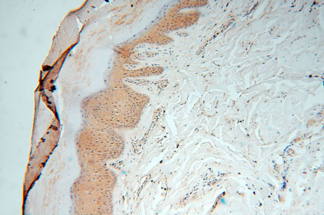 PGAM2 Antibody in Immunohistochemistry (Paraffin) (IHC (P))