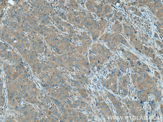 PGAM2 Antibody in Immunohistochemistry (Paraffin) (IHC (P))