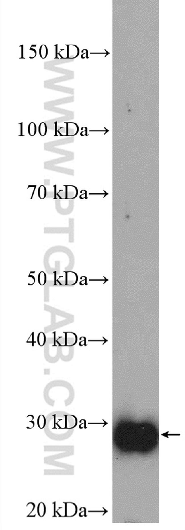 PGAM2 Antibody in Western Blot (WB)