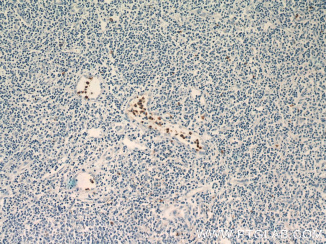 NOXA2/p67phox Antibody in Immunohistochemistry (Paraffin) (IHC (P))