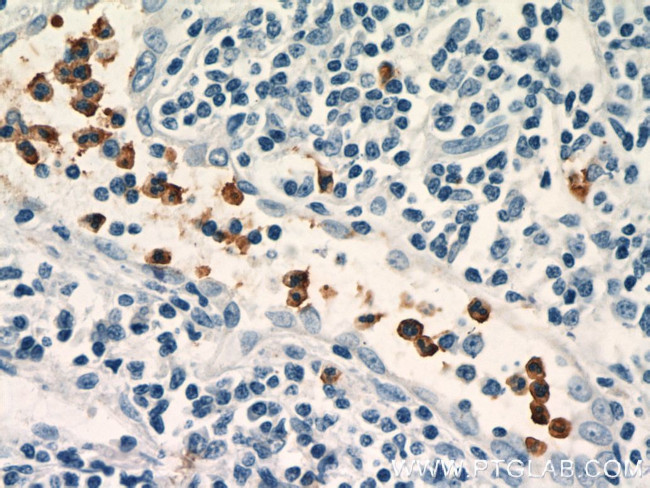 NOXA2/p67phox Antibody in Immunohistochemistry (Paraffin) (IHC (P))