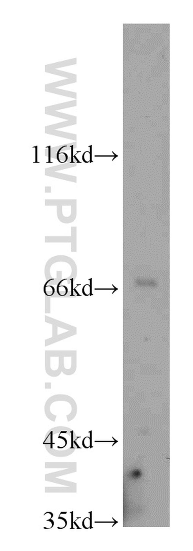 NOXA2/p67phox Antibody in Western Blot (WB)