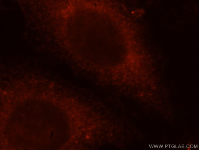 TRAPPC3 Antibody in Immunocytochemistry (ICC/IF)