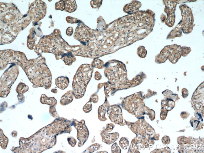 TRAPPC3 Antibody in Immunohistochemistry (Paraffin) (IHC (P))