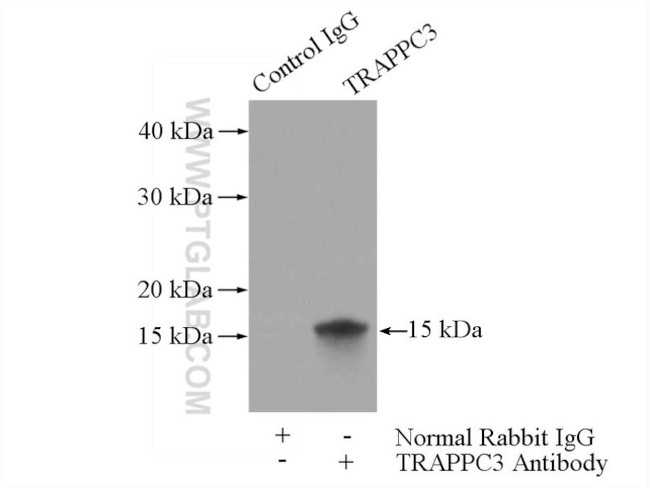 TRAPPC3 Antibody in Immunoprecipitation (IP)