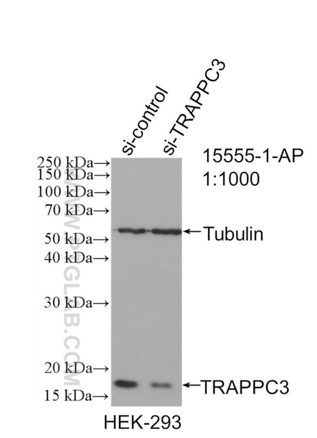 TRAPPC3 Antibody in Western Blot (WB)