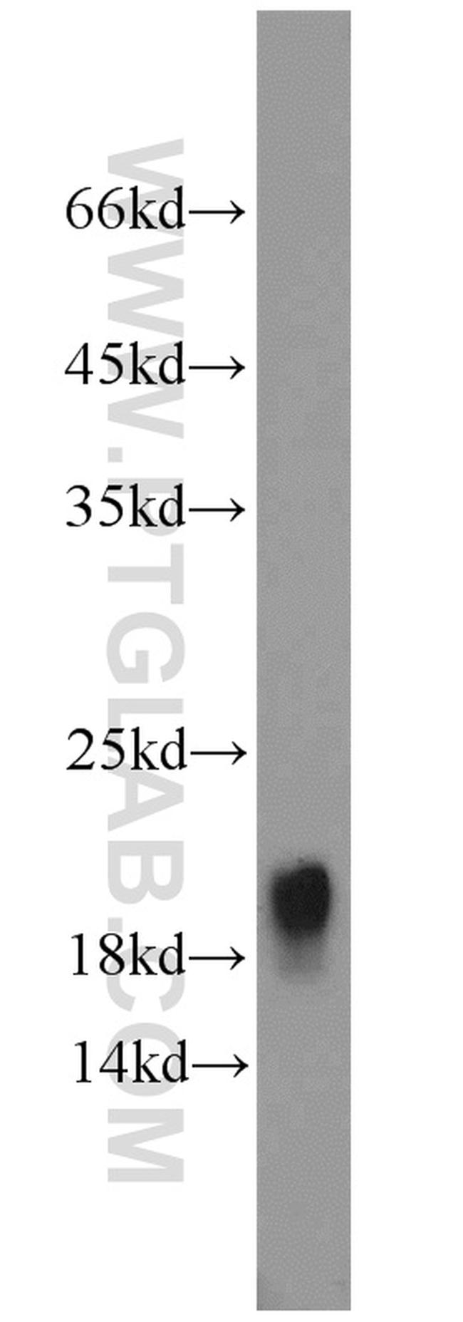 TRAPPC3 Antibody in Western Blot (WB)