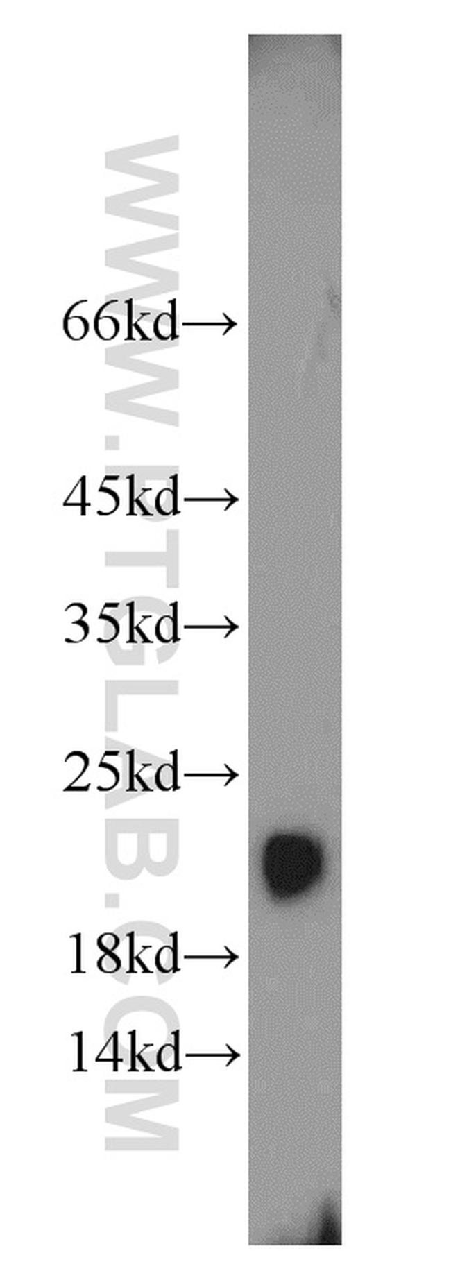 TRAPPC3 Antibody in Western Blot (WB)