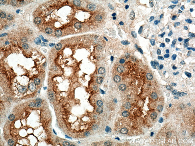 Syntaxin 3 Antibody in Immunohistochemistry (Paraffin) (IHC (P))