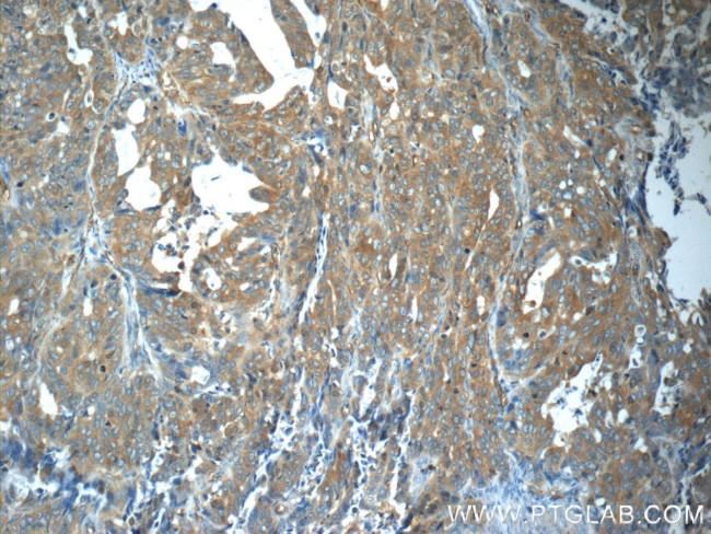 ZNF259 Antibody in Immunohistochemistry (Paraffin) (IHC (P))