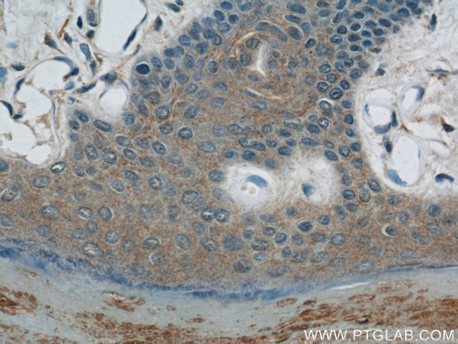 ZNF259 Antibody in Immunohistochemistry (Paraffin) (IHC (P))