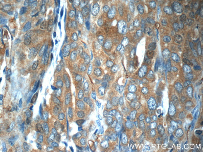 ZNF259 Antibody in Immunohistochemistry (Paraffin) (IHC (P))