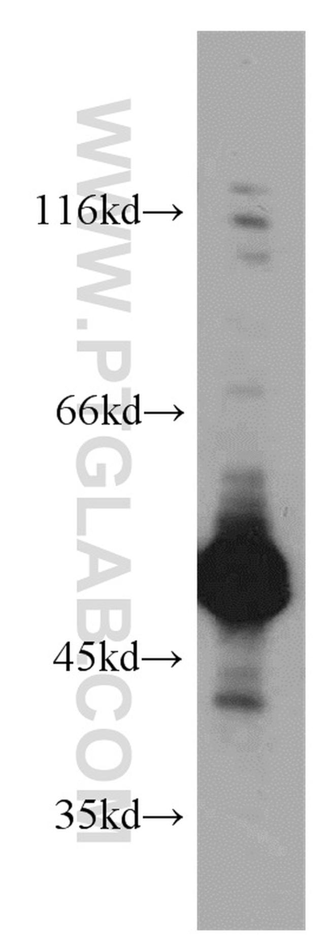 ZNF259 Antibody in Western Blot (WB)