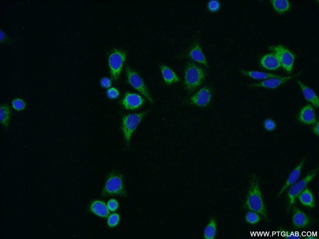 ALDH1B1 Antibody in Immunocytochemistry (ICC/IF)