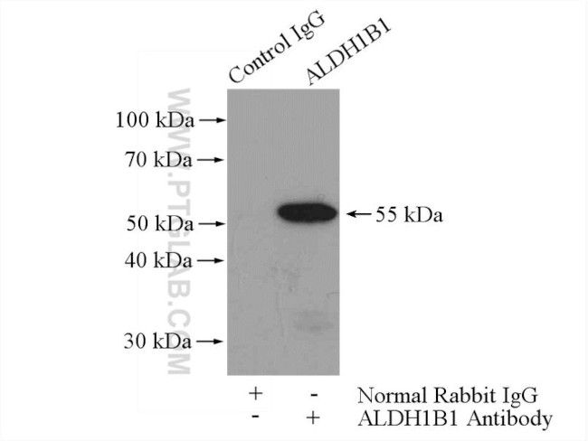 ALDH1B1 Antibody in Immunoprecipitation (IP)