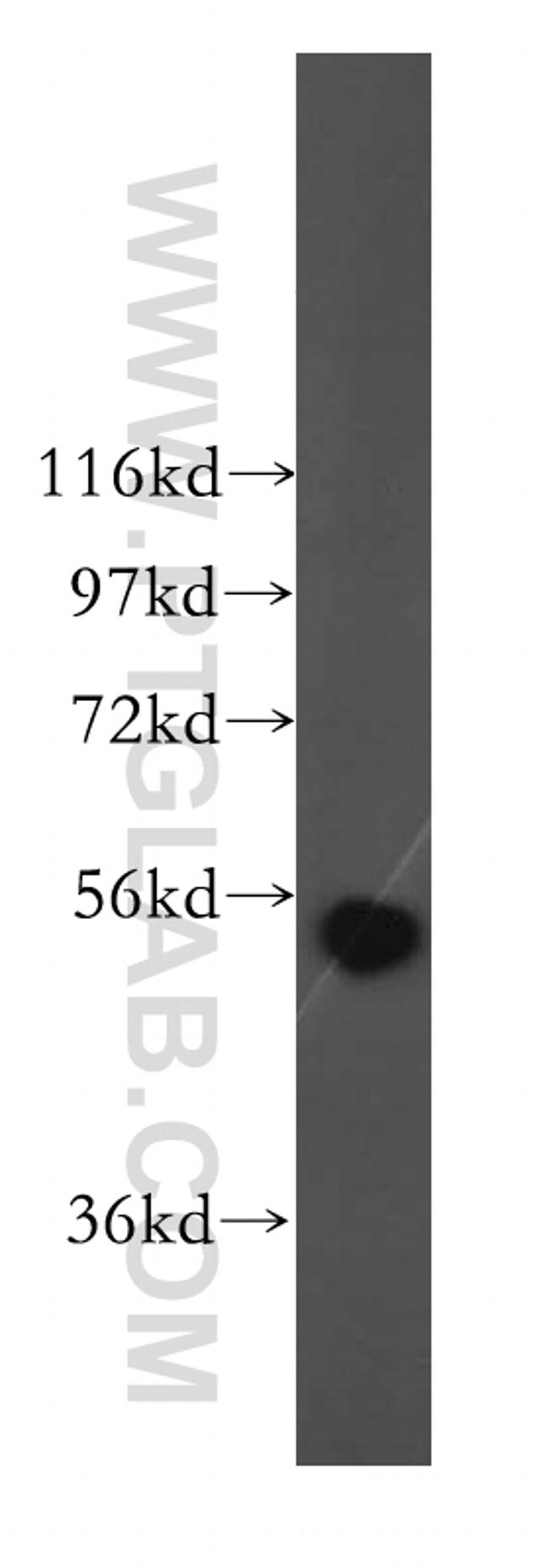 ALDH1B1 Antibody in Western Blot (WB)