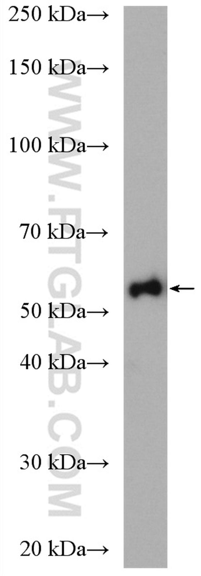 ALDH1B1 Antibody in Western Blot (WB)