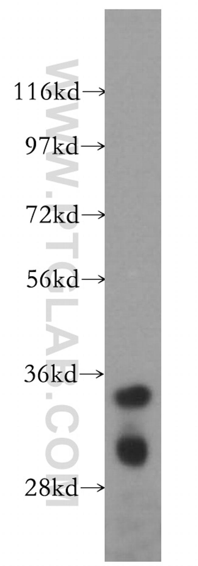 DIMT1L Antibody in Western Blot (WB)