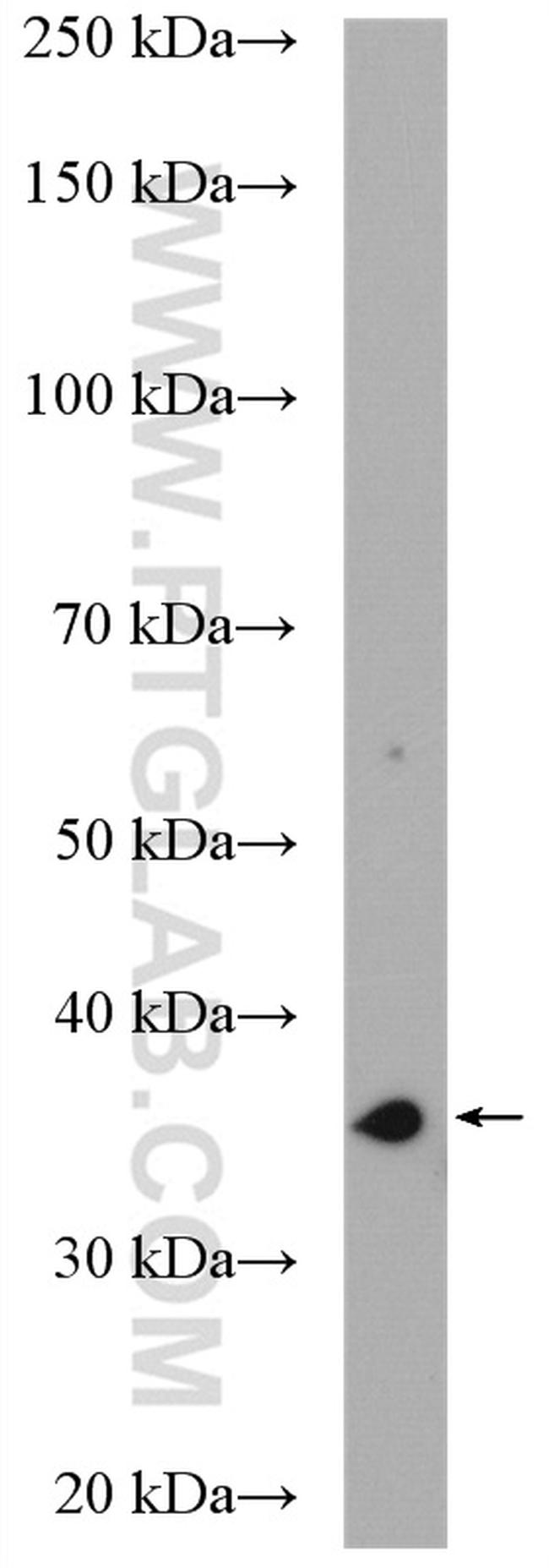 DIMT1L Antibody in Western Blot (WB)