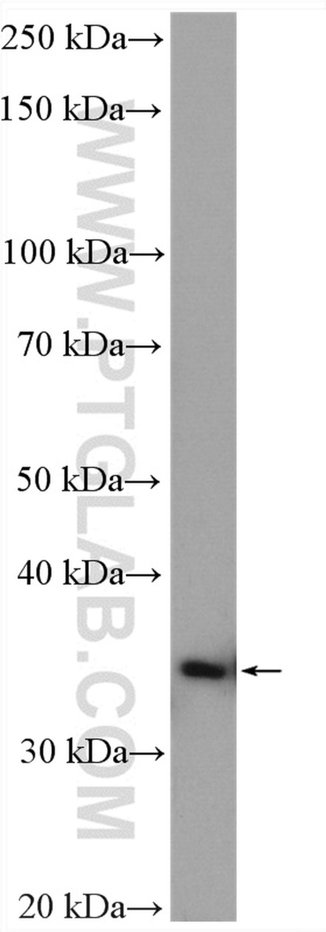 DIMT1L Antibody in Western Blot (WB)