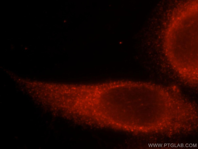 Flotillin 1 Antibody in Immunocytochemistry (ICC/IF)