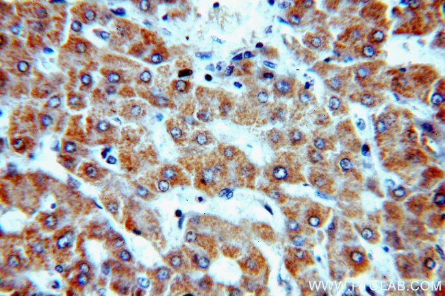 NDUFC2 Antibody in Immunohistochemistry (Paraffin) (IHC (P))