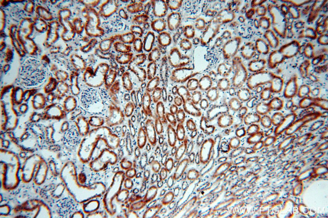 NDUFC2 Antibody in Immunohistochemistry (Paraffin) (IHC (P))