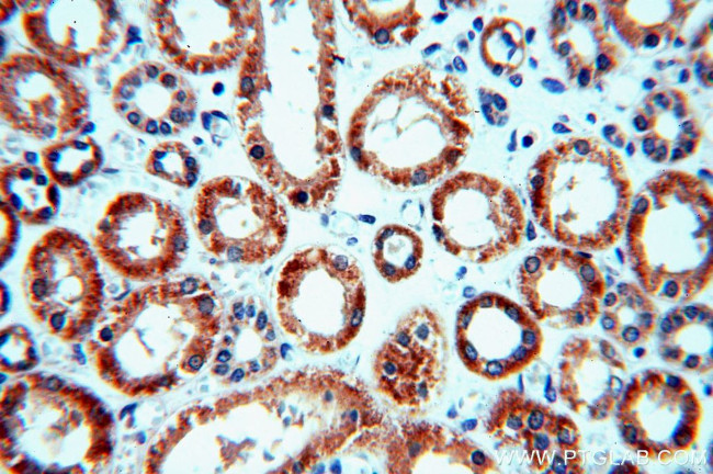 NDUFC2 Antibody in Immunohistochemistry (Paraffin) (IHC (P))