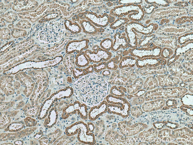 NDUFC2 Antibody in Immunohistochemistry (Paraffin) (IHC (P))