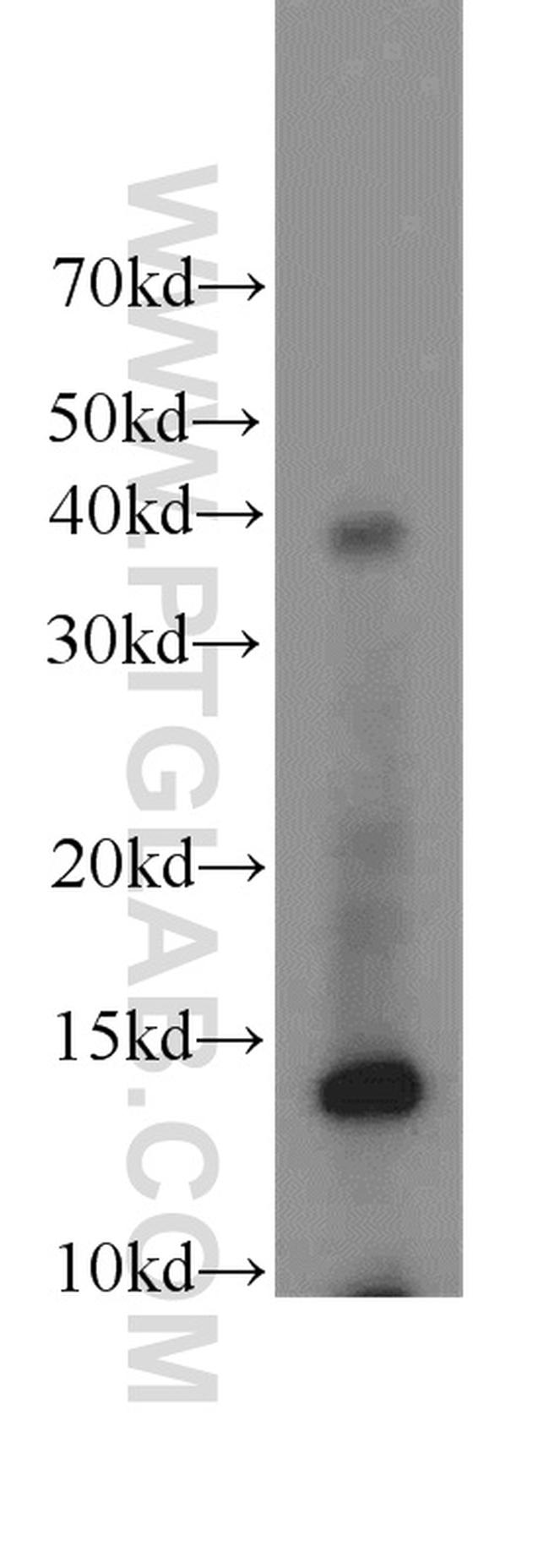 NDUFC2 Antibody in Western Blot (WB)