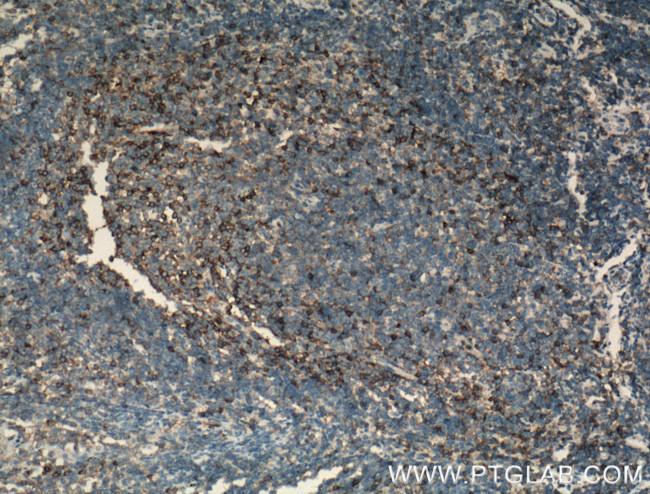 CD11a/Integrin Alpha L Antibody in Immunohistochemistry (Paraffin) (IHC (P))