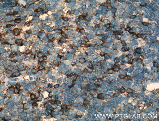 CD11a/Integrin Alpha L Antibody in Immunohistochemistry (Paraffin) (IHC (P))