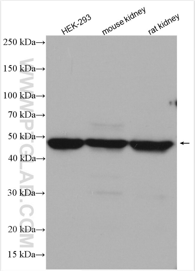 ALDH3A1 Antibody in Western Blot (WB)