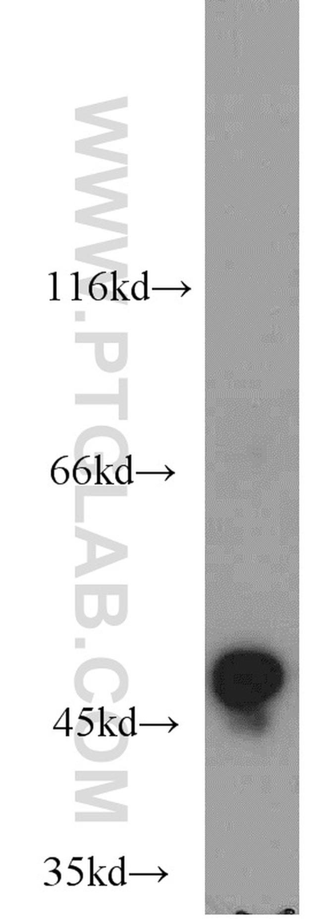 ALDH3A1 Antibody in Western Blot (WB)