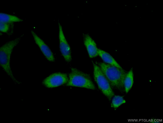 PAIP2 Antibody in Immunocytochemistry (ICC/IF)