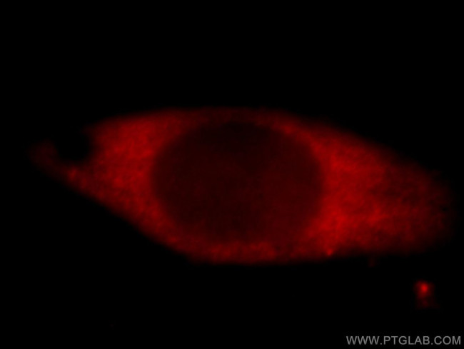 PAIP2 Antibody in Immunocytochemistry (ICC/IF)